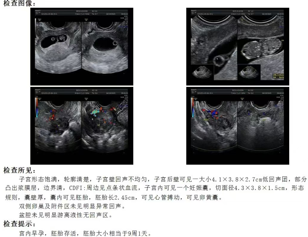 孕检报告单的制作过程